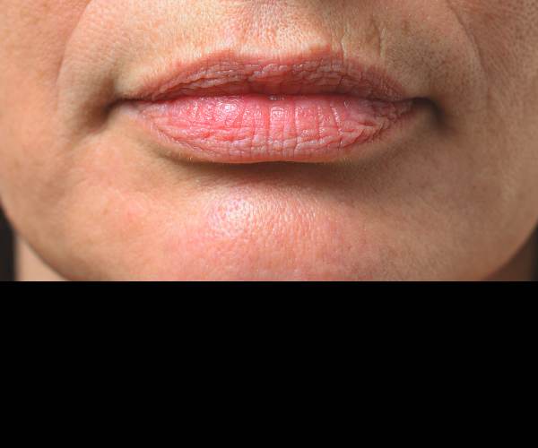 Lips