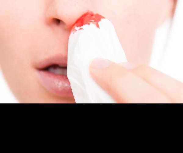 Bleed